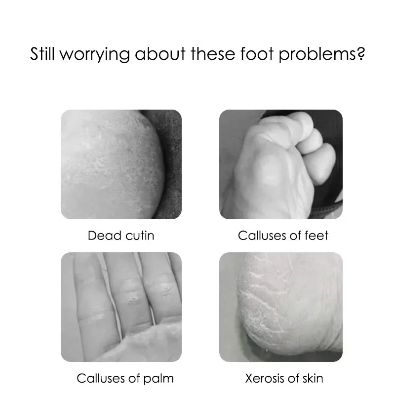 Professional foot pedicure kit